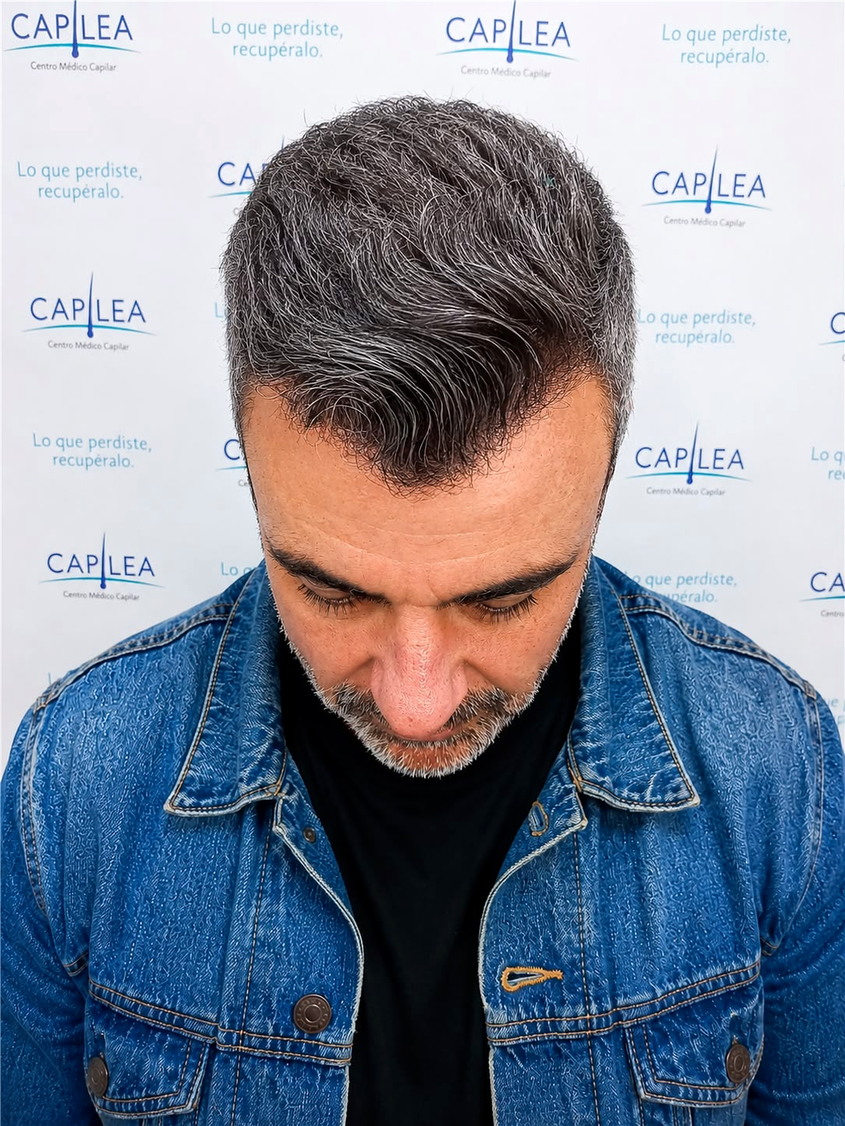 Después de la restauración capilar